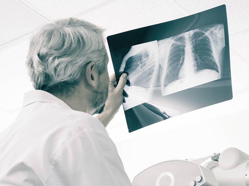 doctor looking at chest x-ray